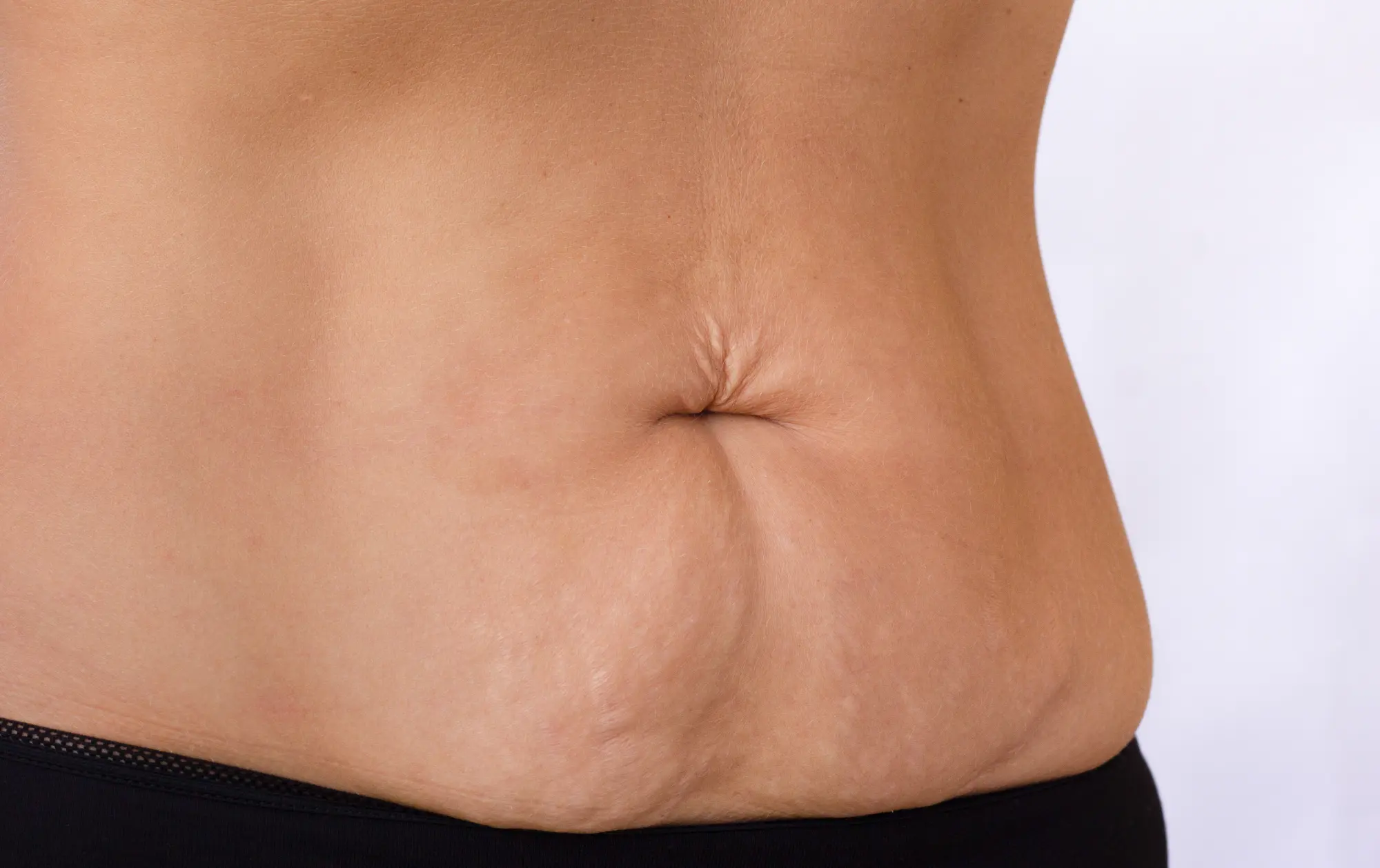 BODY CONTOURING & WELLNESS 8 Skin laxity treatment condition By Enhanced Wellness In Albuquerque NM